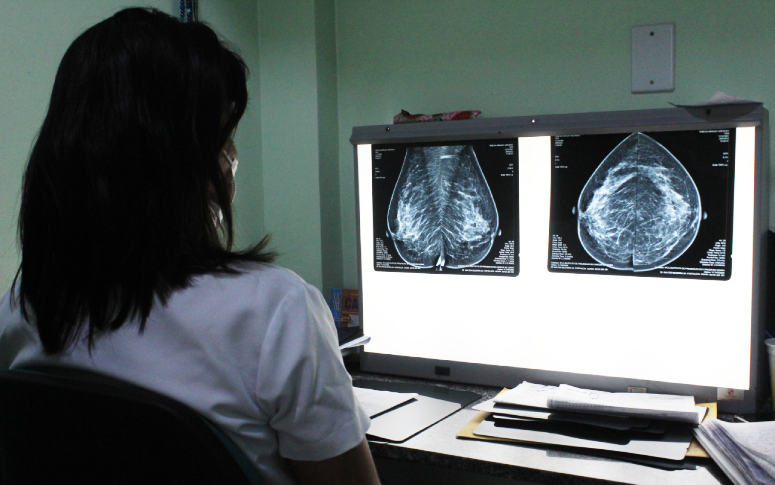 Mamografia auxilia o diagnóstico precoce do câncer de mama; IPC tem capacidade para 40 exames diários via Central de Regulação