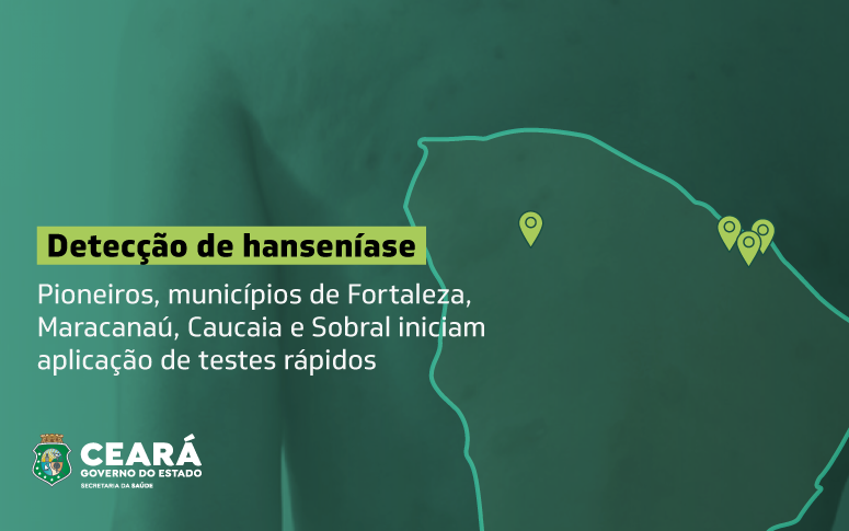 Desinformação e preconceito afastam pessoas com hanseníase de tratamento,  oferecido gratuitamente pelo SUS - Governo do Estado do Ceará